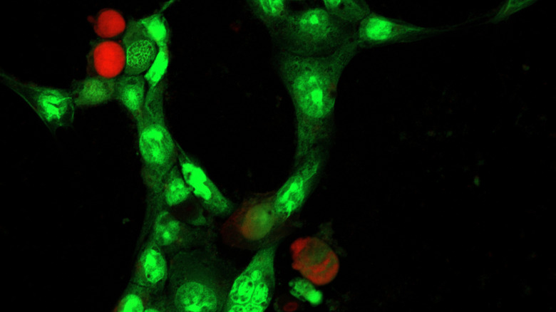 Microscopic view of HeLa cells