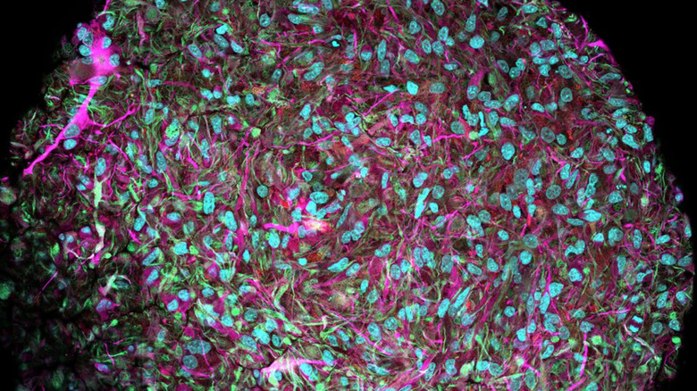 Magnified image of a brain organoid