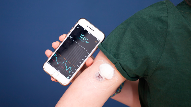 Continuous glucose monitor on arm