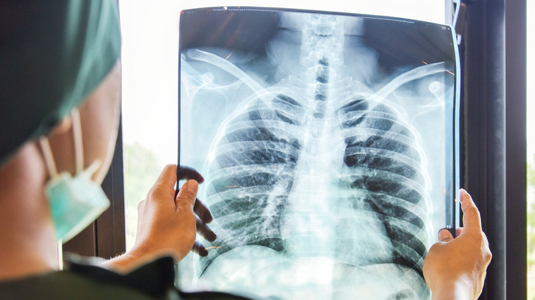 A doctor looking at an x-ray