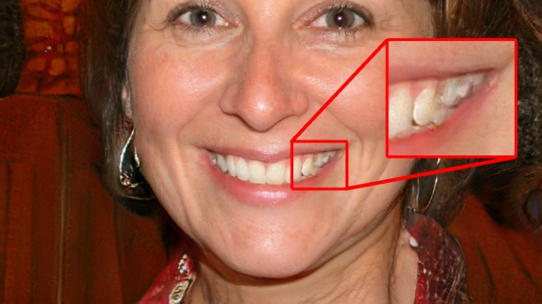 AI-generated picture woman teeth