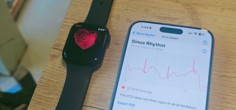 ECG system on Apple Watch